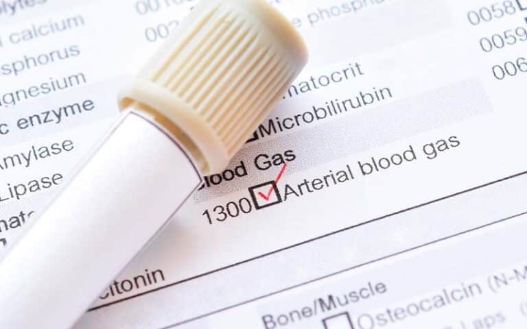 Come-si-esegue-una-emogasanalisi-arteriosa